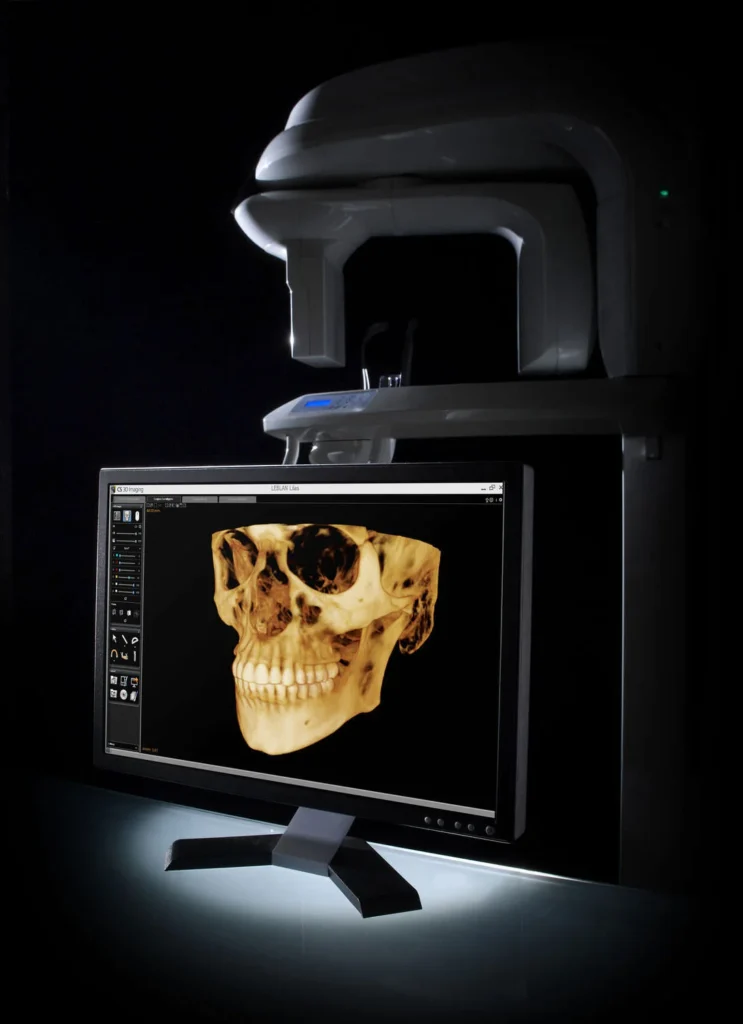 CS 9300 (CT Scanner)