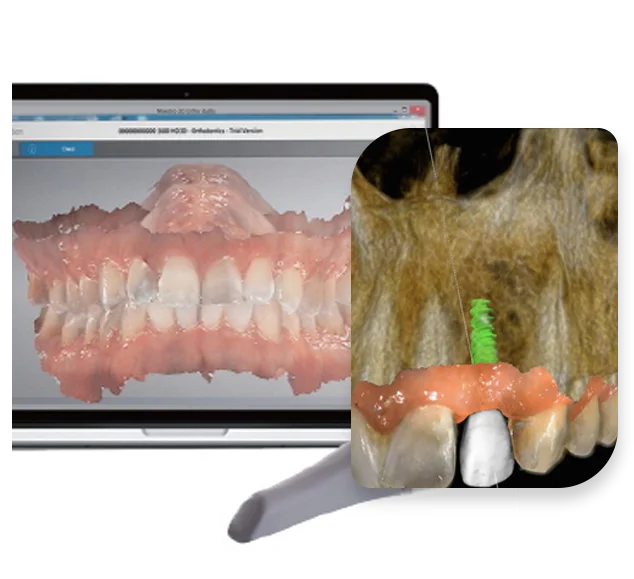 Digital-Dental-Impressions