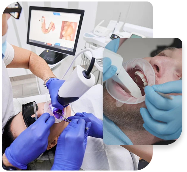 Impacted-Teeth-Procedure